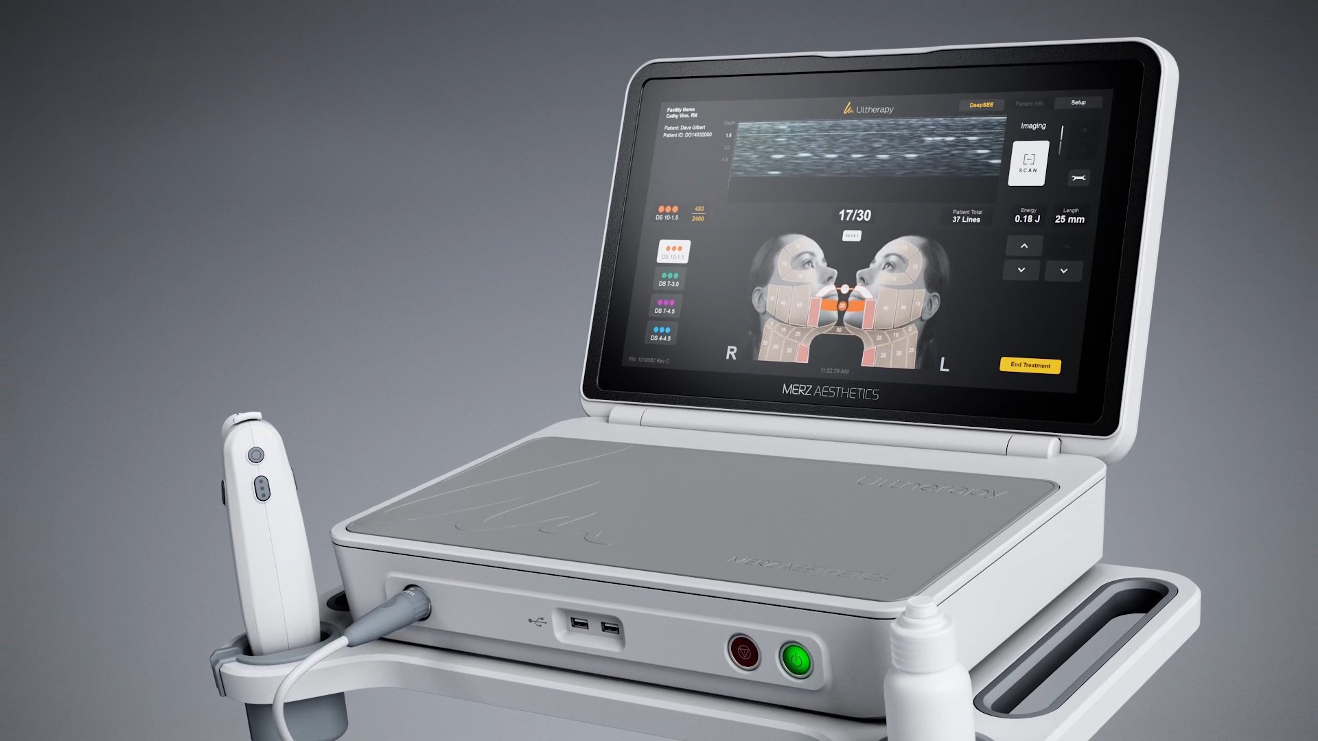 ultherapy prime image